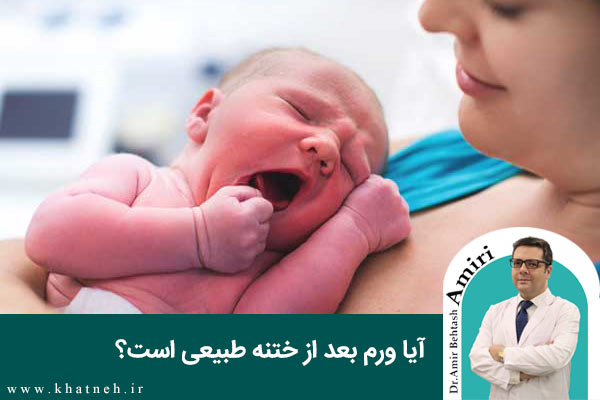 ورم بعد از ختنه | کلینیک ختنه نوزادان تهران|دکتر امیری