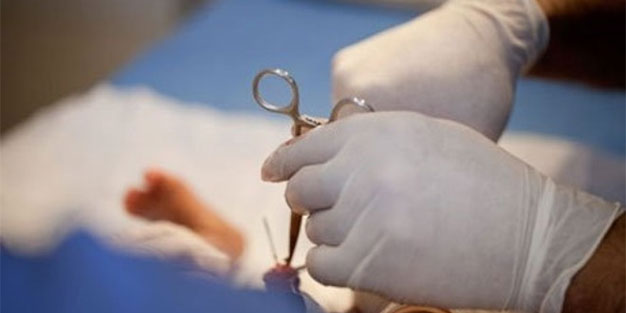 تزریق داخل آلت تناسلی در جراحی ختنه زیبایی