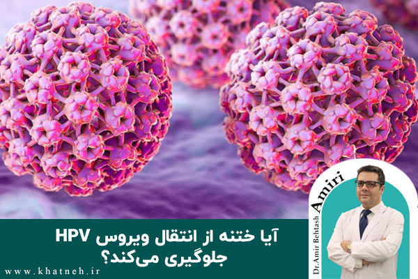 ویروس HPV و کاهش انتقال با ختنه | دکتر امیری