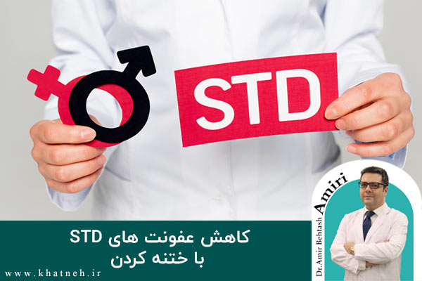 عفونت های STD و نقش ختنه در کاهش آن