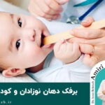 برفک دهان نوزادان و کودکان؛ علل و درمان