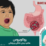 روتاویروس؛ علائم، درمان خانگی و پزشکی