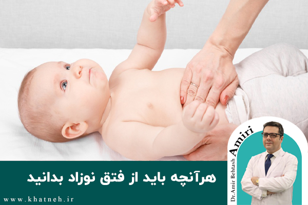 درباره این مقاله بیشتر بخوانید هرآنچه باید از فتق نوزاد بدانید