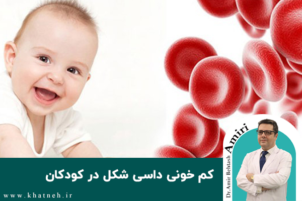 کم خونی داسی شکل در کودکان