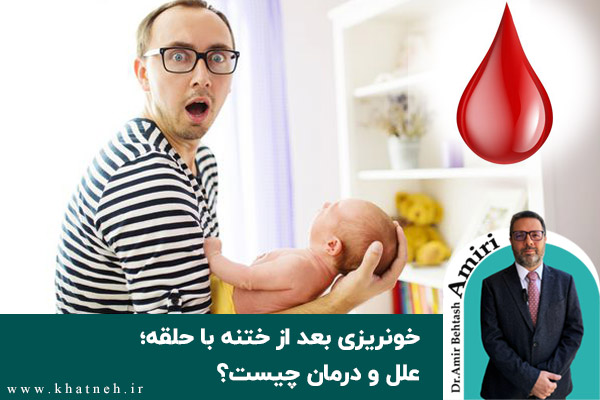خونریزی-بعد-از-ختنه-با-حلقه؛-علل-و-درمان-چیست-کلینیک-ختنه-نوزادان-تهران-دکتر-امیری