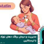 مدیریت و درمان برفک دهان نوزاد با نیستاتین