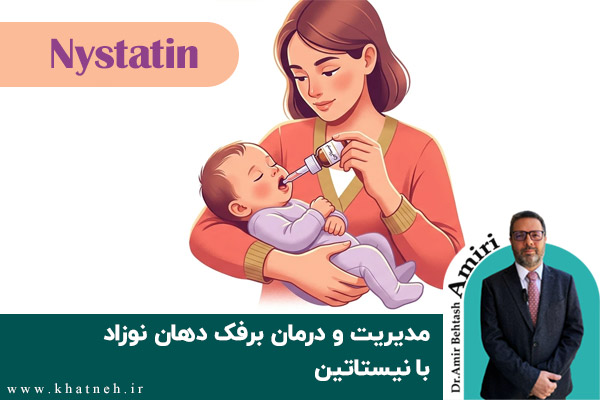 مدیریت و درمان برفک دهان نوزاد با نیستاتین